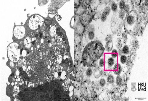 Vì sao virus HIV có thể đứng đằng sau sự xuất hiện của Omicron?