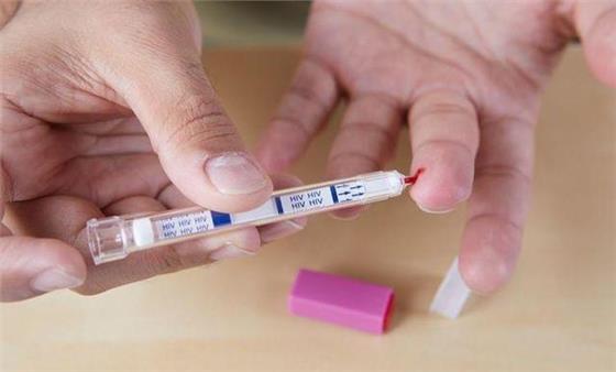 Tìm hiểu về xét nghiệm anti HIV