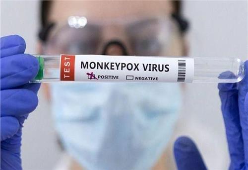 Ca mắc bệnh đậu mùa khỉ đầu tiên tại Việt Nam thuộc chủng có nguồn gốc từ Tây Phi