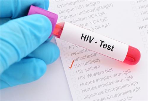 Cảnh giác với các triệu chứng HIV theo từng giai đoạn