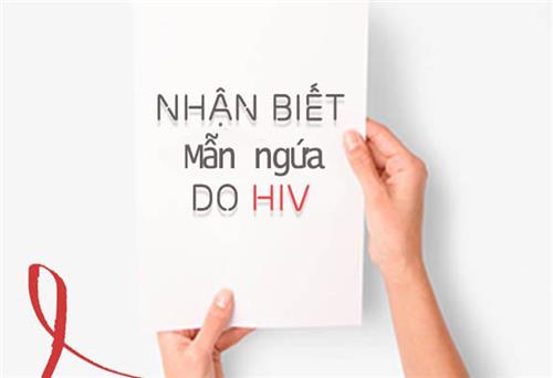 Nhận biết nổi mề đay do nhiễm virus HIV