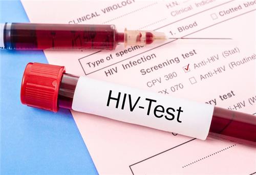 Khuyến nghị mới về xét nghiệm HIV giúp mở rộng phạm vi điều trị