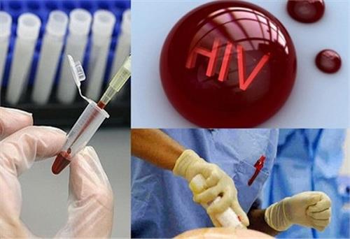 Mỹ: Thử nghiệm thuốc chống phơi nhiễm HIV cho kết quả khả quan