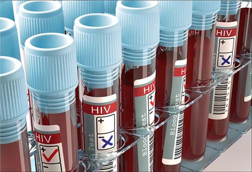 Dự kiến ra mắt vaccine phòng HIV vào năm 2021