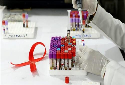  HIV đột biến đẩy nhanh quá trình phát triển AIDS