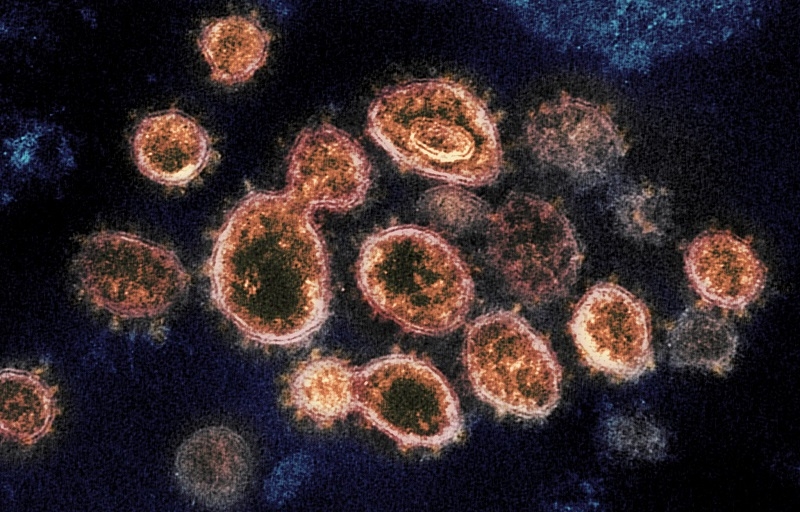   Virus gây ra COVID-19, được gọi là SARS-CoV-2 dưới kính hiển vi điện tử.